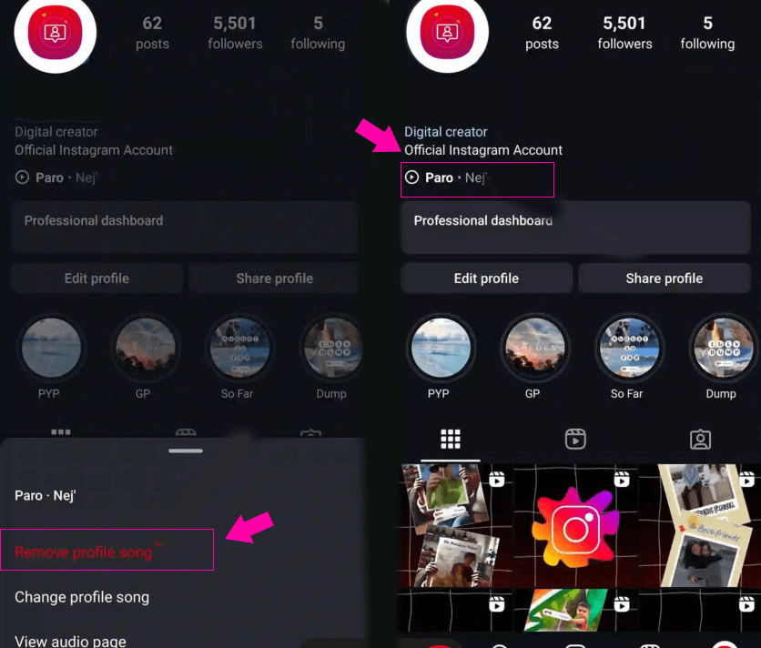 How to delete a song that we have added to the Instagram profile?