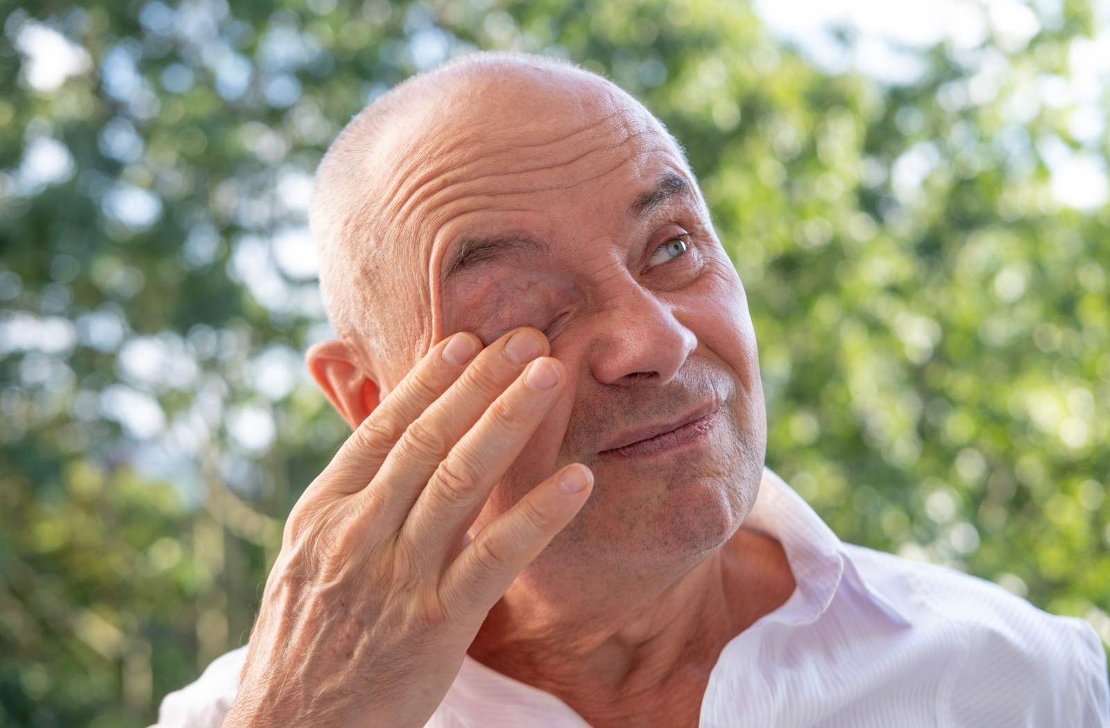 A person standing outdoors rubs their eye which is being affected by allergies.