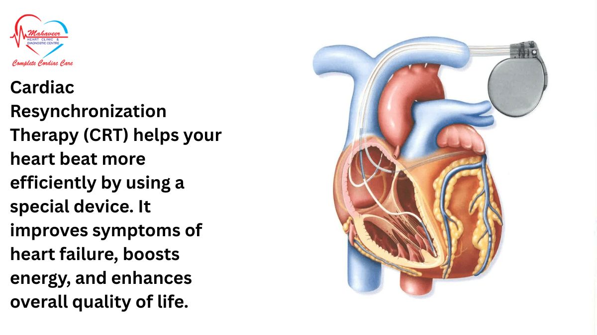 Cardiac-Resyncronization-Dr Rakesh Jain a Top cardiologist In Indore