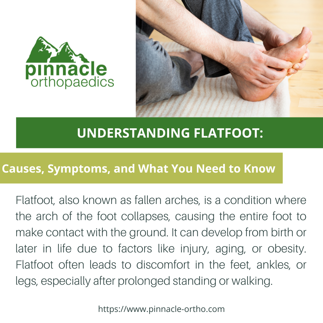 Managing Flatfoot and Arch Pain