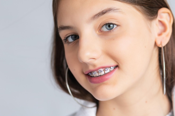 metal braces
clear aligners
metal braces singapore
clear aligners singapore
metal braces singapore cost
clear aligners singapore cost