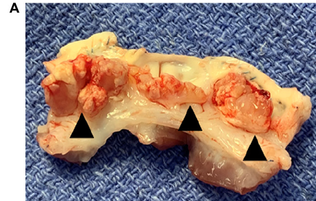 Valve leaflets of pig